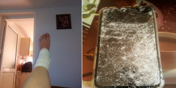 O femeie bătută în faţa unei secţii de votare din Slătioara Vâlcea în ziua alegerilor parţiale s-a ales cu un picior luxat şi telefonul spart Foto colaj Florina Cică
