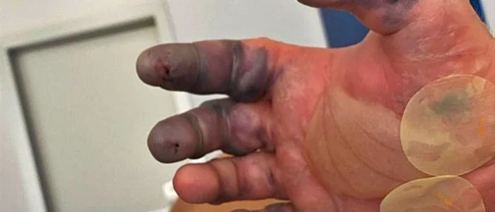 tanar muşcat de un păianjen pustnic maro Foto diariodeibiza es