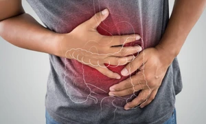 calarasi alimentatia necorespunzatoare declanseaza gastrita foto digestmed.ro