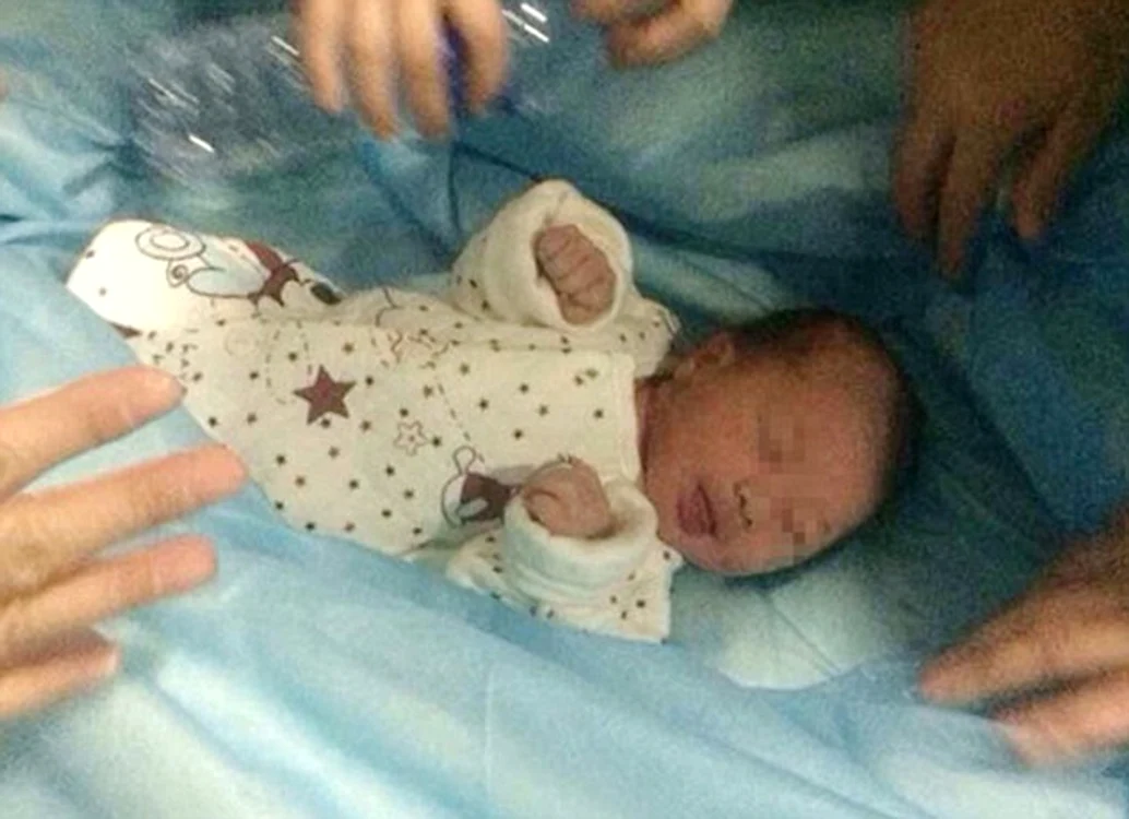 
    Micuţul Xiaoxiao s-a născut a doua oarăfoto: Daily Mail  