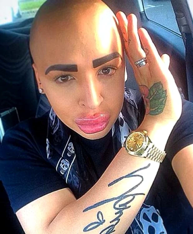 Are mai multe operaţii estetice