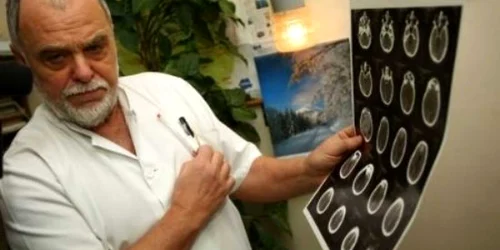 Medicul care l-a operat pe poliţist spune că acesta se poate pensiona