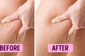 Ia ţi adio de la celulită! Ce conţine crema care îţi va face picioarele frumoase şi catifelate jpeg