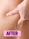 Ia ţi adio de la celulită! Ce conţine crema care îţi va face picioarele frumoase şi catifelate jpeg