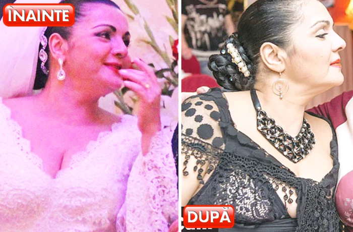 Vedete care au renunțat la silicoane. Cornelia Catanga nu mai putea ține acordeonul pe piept