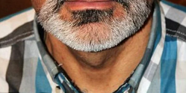 gene