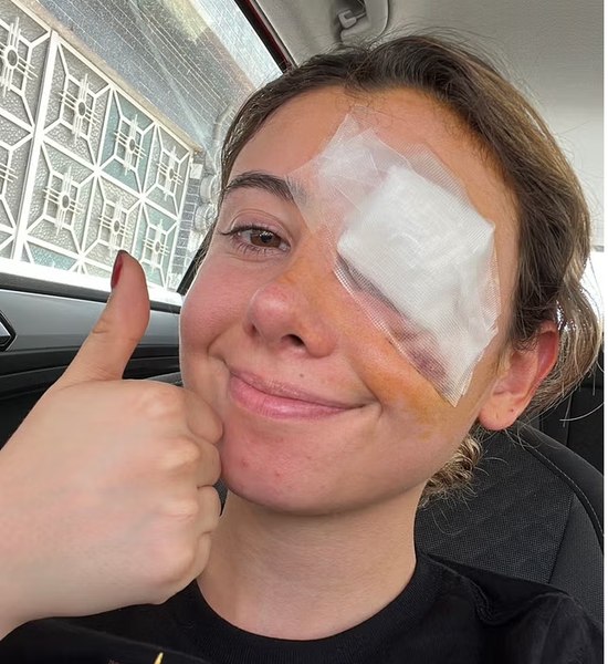 A ajuns la operație după ce s-a demachiat. Coșmarul unei tinere care a apelat la un truc de pe Tik Tok: „Nu a funcționat la mine“