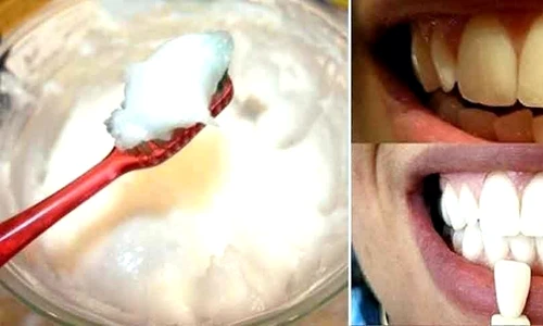 1 remedii albire dinti jpg jpeg