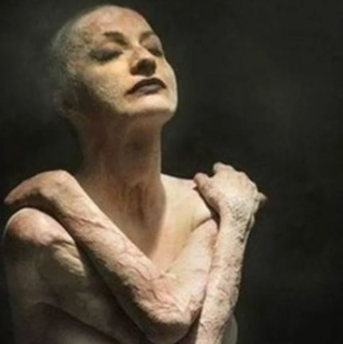 Tedy Ursuleanu a făcut cunoștință cu noua sa mână bionică Foto: Facebook