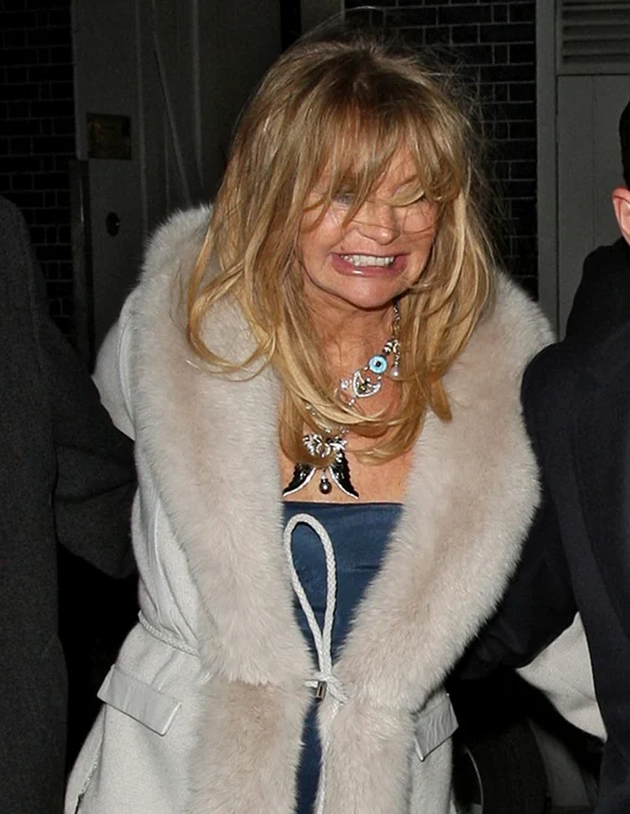 Vedete bete! Ipostaze stânjenitoare cu celebrităţile de peste hotare