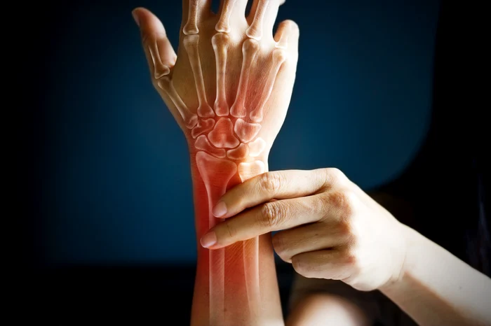 
    Nutriționiștii consideră că în tratarea diferitelor boli este benefic laptele de capră în comparație cu alte tipuri de laptefoto: Shutterstock  