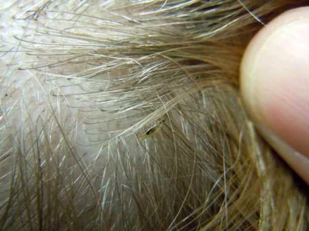 Foto: behealthiers.com