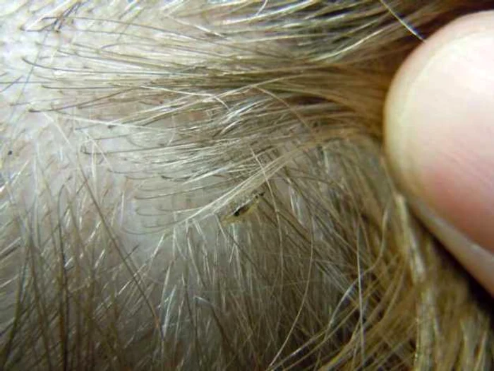 Foto: behealthiers.com
