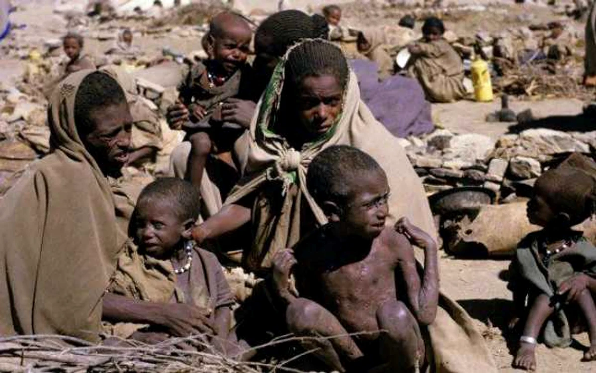 Copii afectati de foamete in Yemen FOTO heureinfos.com