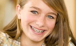 fata aparat dentar fotolia 10421549  jpeg