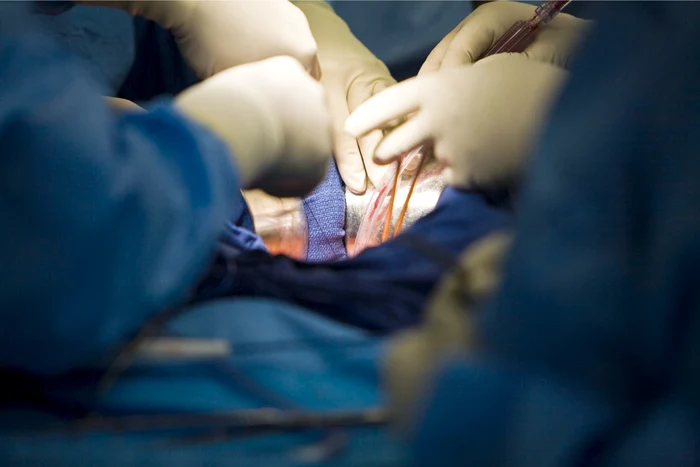 Operaţia a avut loc la un spital din Shanghai