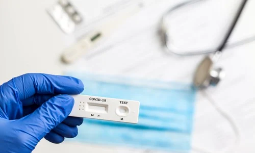 1 test covid acasa jpg jpeg