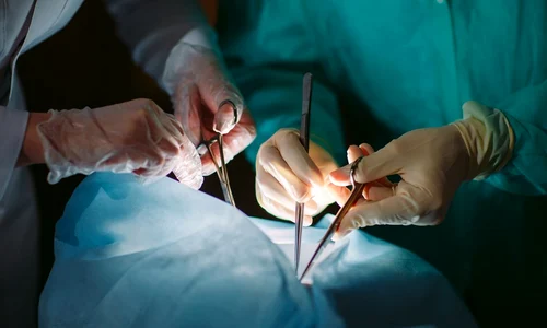 transplant hepatic jpg