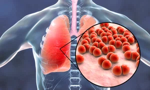 1 bacteria streptococcus 1062330374 jpg jpeg