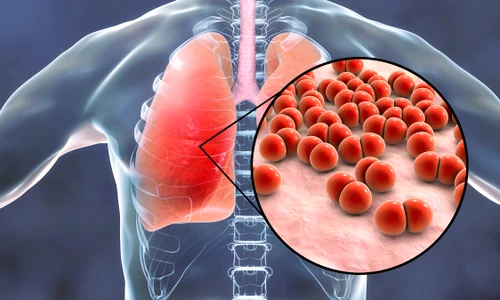 1 bacteria streptococcus 1062330374 jpg jpeg