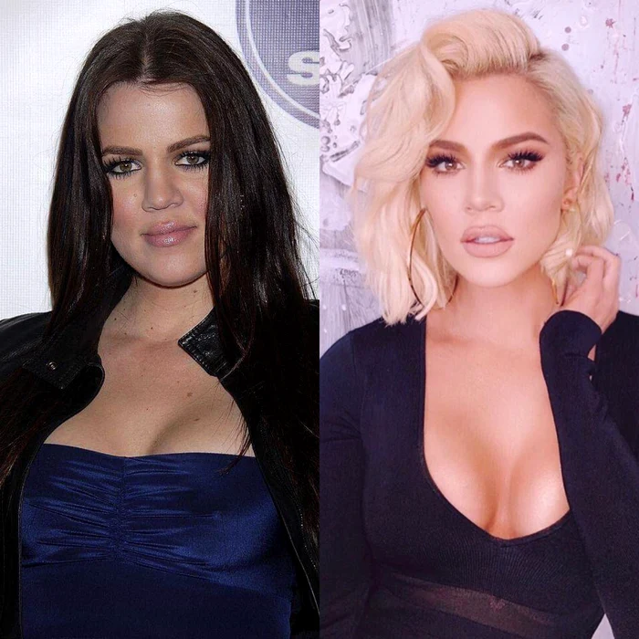 Khloe este adesea acuzată că își editează în exces pozele publicate pe rețelele de socializare, însă cu siguranță există și intervenții estetice în ceea ce o privește