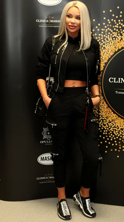 Bianca Drăguşanu se teme de operaţia de menisc