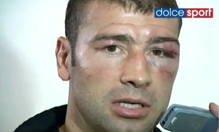 Lucian Bute are faţa distrusă