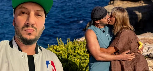 De ce poartă Nick nnd dispozitivul negru pe nas la Power Couple și în viața de toate zilele  La ce îl ajută!   