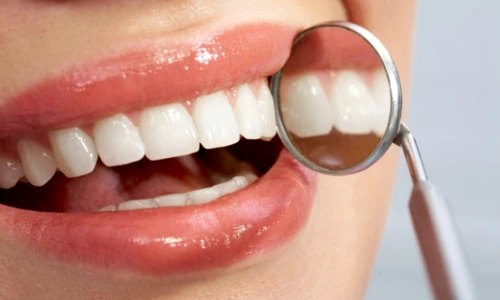 1 73967 original jpg jpeg