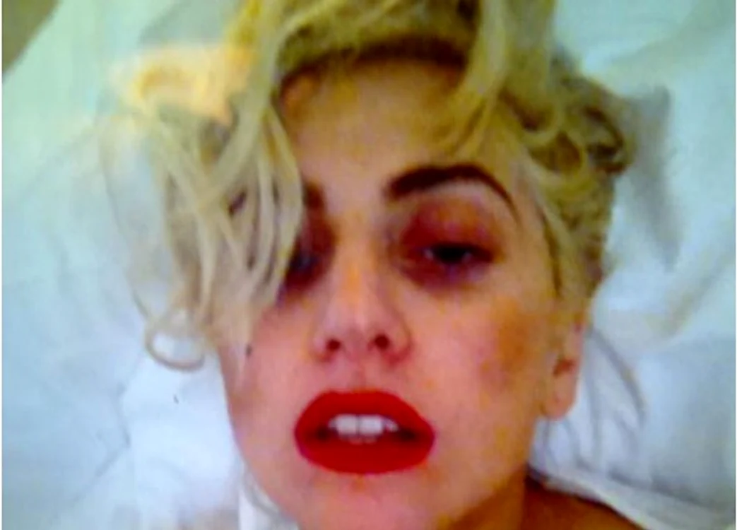
    Fotografia postată de Lady Gaga după incidentul din Noua Zeelandă (foto: Twitter)  
