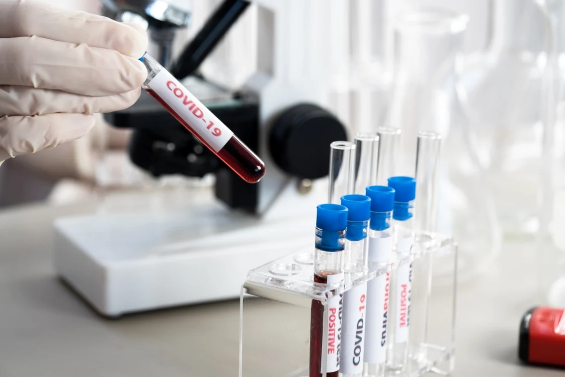 Acest tip de anticorpi neutralizează SARS-CoV-1 Foto: Arhivă