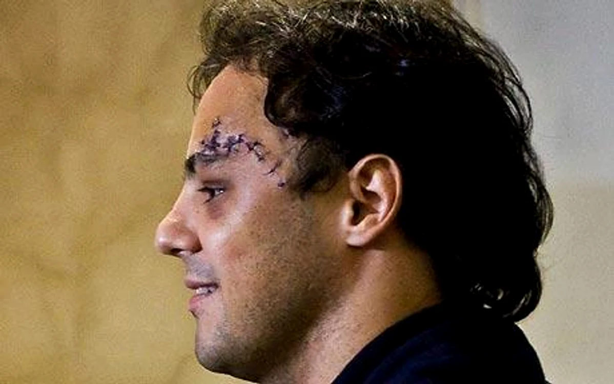
    Felipe Massa: «Am o gaură în cap»  
