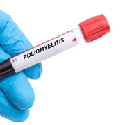 Poliomielita FOTO Shutterstock