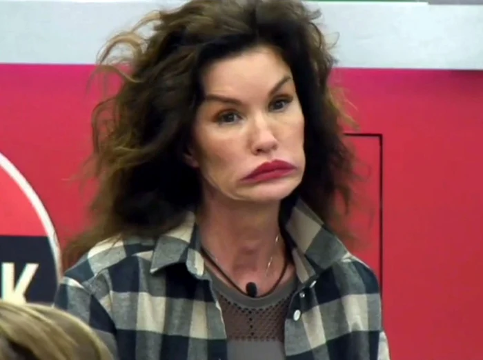 
    Era o frumusețe, dar a descoperit intervențiile estetice  