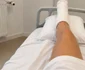 Ana-Maria Socaciu, pe patul de spital, la Spitalul Universitar, după operația la picior 