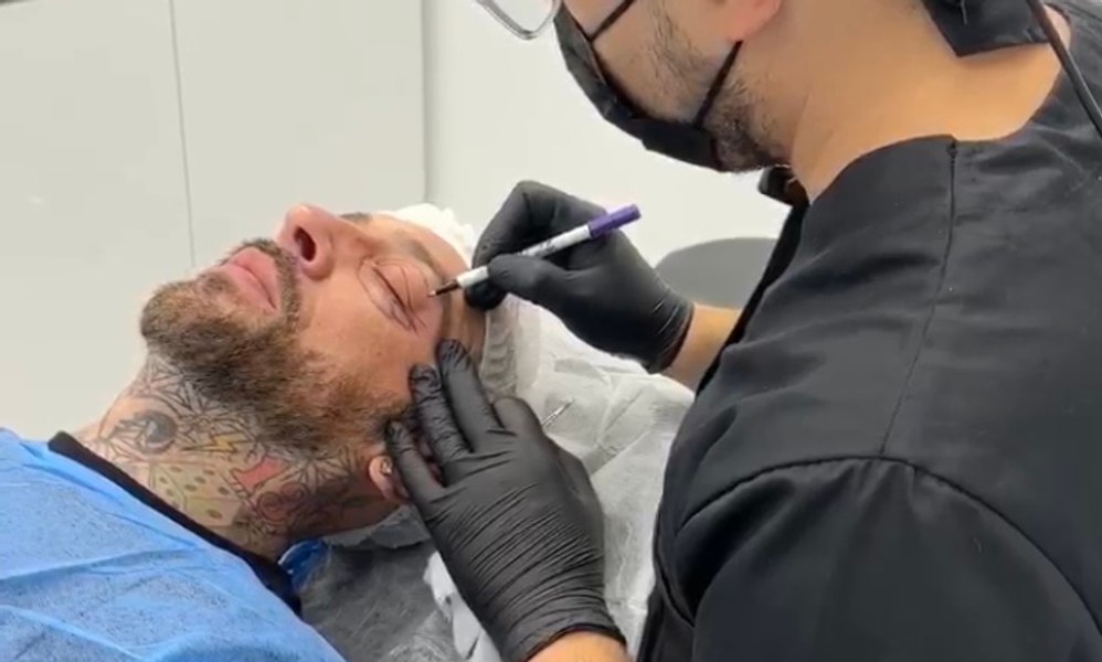 Cum arată CRBL după operația estetică la care a recurs: „Sper ca recuperarea să fie ușoară”
