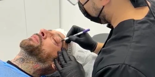 CRBL și-a făcut blefaroplastie la medicul Alin Bortolini foto: arhiva personală 