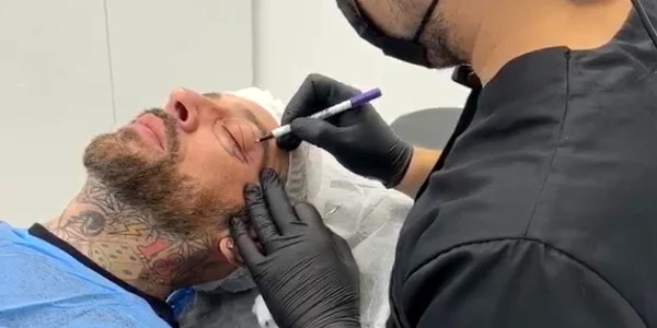 CRBL și-a făcut blefaroplastie la medicul Alin Bortolini foto: arhiva personală 