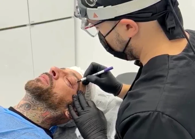 CRBL, înainte de intervenția estetică. FOTO Instagram