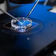 16 IULIE Fertilizare in vitro dr  Stan Alexandru png