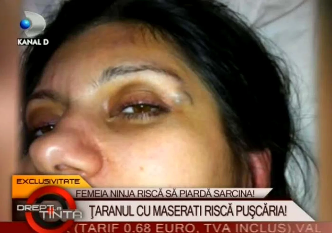 
    Victima lui Petre Crăete  