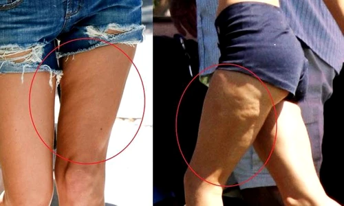 Legătura dintre lenjeria de corp şi celulită  Multe femei fac această greşeală jpeg