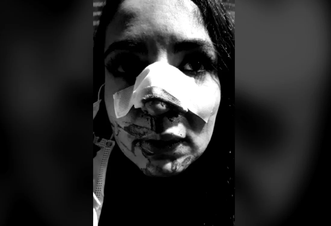 
    Cristina Joia s-a ales cu nasul rupt în urma ataculuiFoto: Facebook  