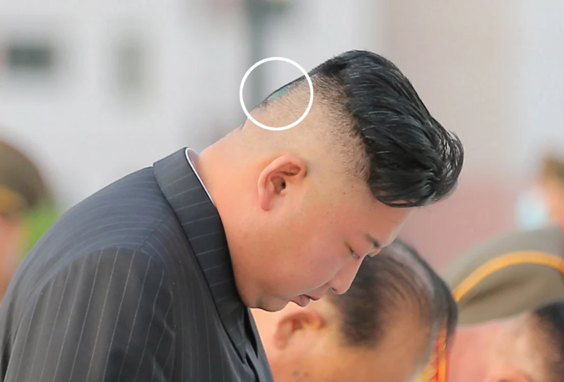 Liderul nord-coreean Kim Jong-un a fost surprins cu un bandaj pe ceafă FOTO captură Twitter