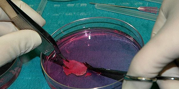 tesut ovarian