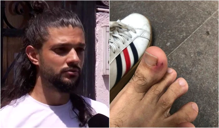 Cătălin, tânărul mușcat de șobolanfoto: Antena3.ro