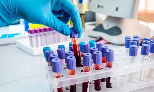 1 shutterstock 327930536 jpg jpeg