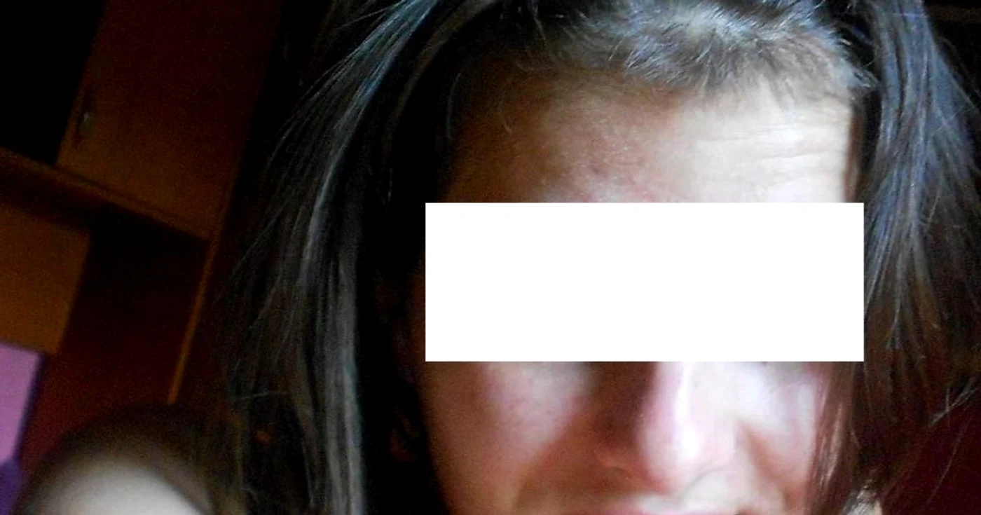 Liceana este internată în spital