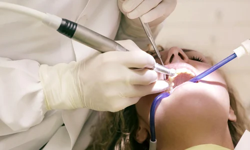 implant dentar jpg