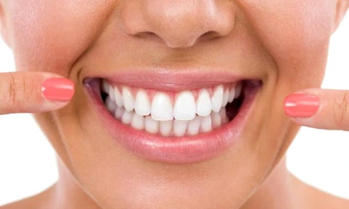 1 83524 original jpg jpeg